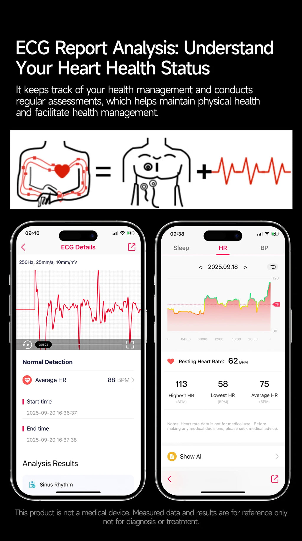 2026 New Micro Physical Examination Health SmartWatch Men ECG Uric Acid Lipids Blood Pressure BT Call Smartwatch For Android IOS