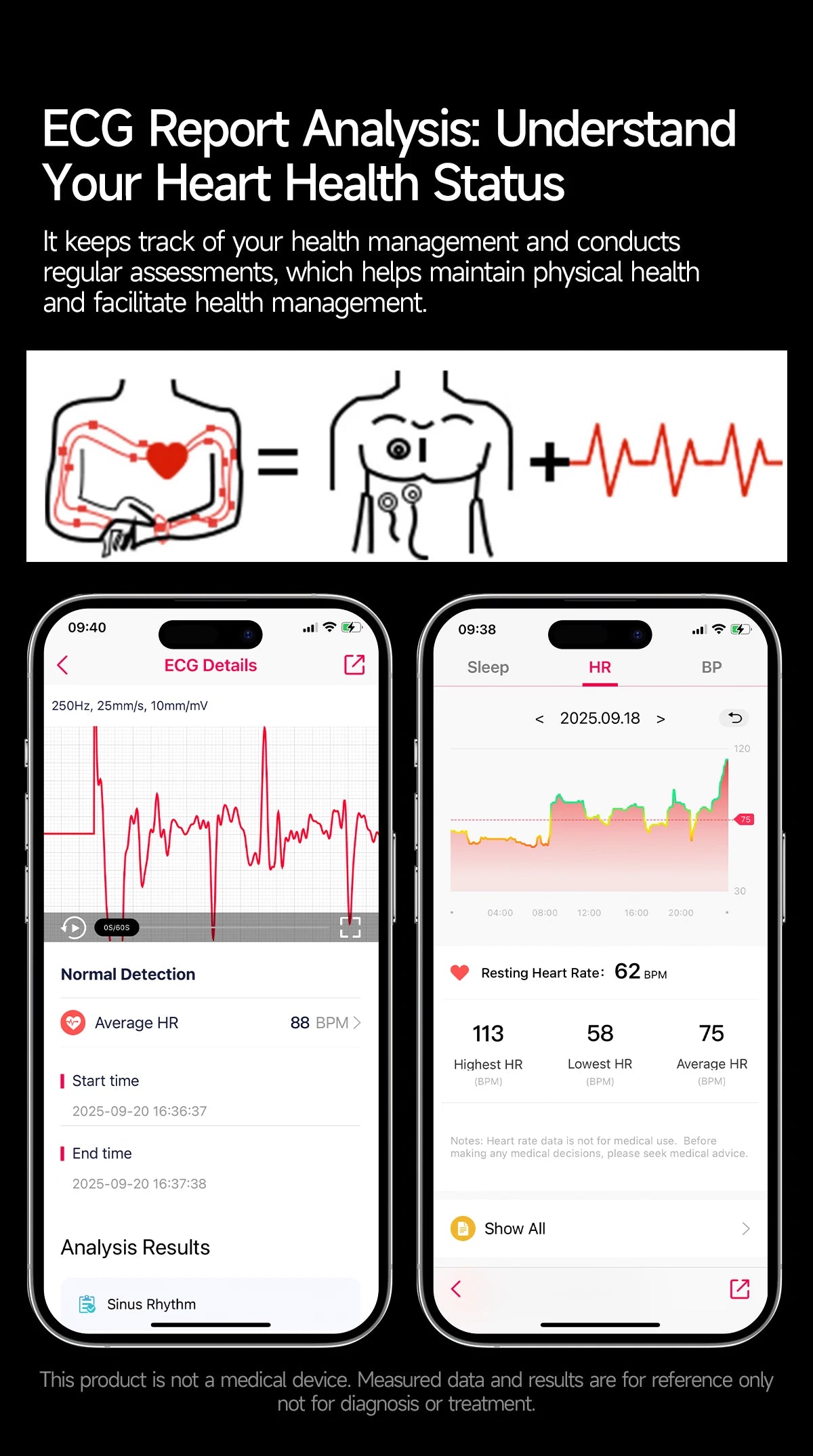 2026 New Micro Physical Examination Health SmartWatch Men ECG Uric Acid Lipids Blood Pressure BT Call Smartwatch For Android IOS