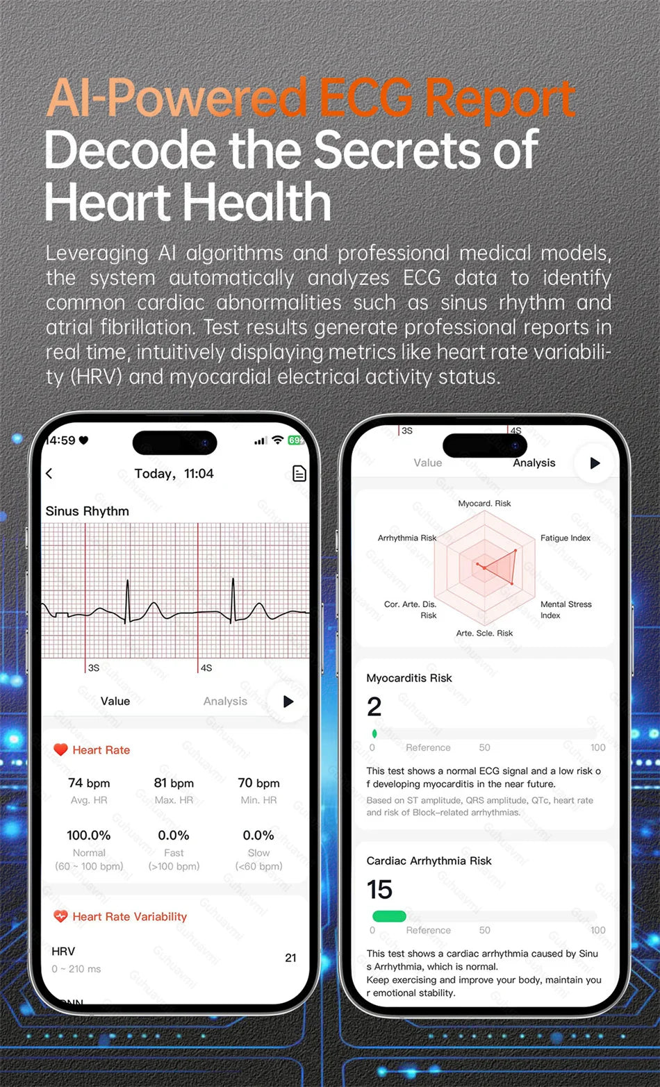 2026 New Smart Watch NFC ECG+PPG Blood oxygen Uric Acid Blood Pressure Sapphire Smartwatch Men For Android iOS Smart watch men