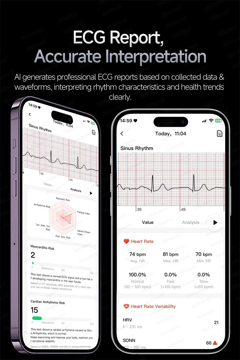 ECG High-end Health Smart Watch Men Blood pressure lipids bloodoxygen Body analysis Uric acid Health Tracker Smartwatch Men lady