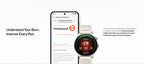 Global Version OnePlus Watch lite SmartWatch,1.46 inches Display,59g,10 Days of Reliable Power,Heart Rate,Blood Oxygen Monitorin