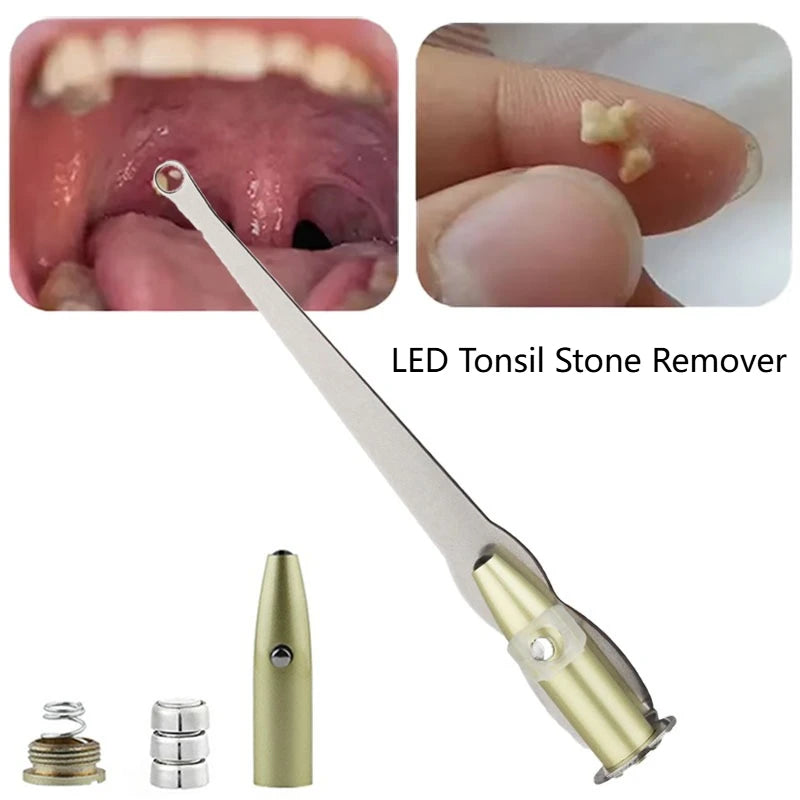 1PC Professional LED Light Tonsil Stone Remover Tool Stainless Steel Cleaner for Oral Care and Ear Wax Removal
