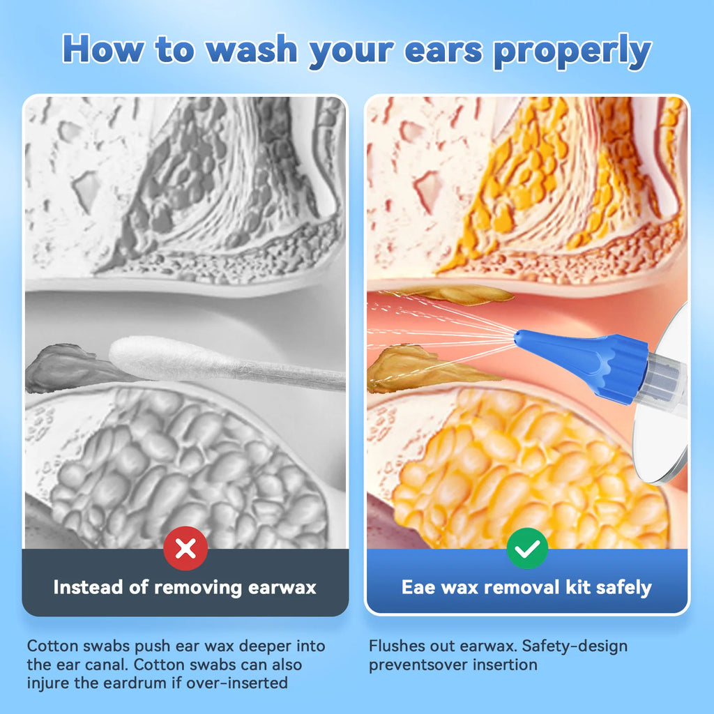 Portable Ear Wax Removal Tools Ear Irrigation Cleaner Home Ear Care Washing Cleaning Tool